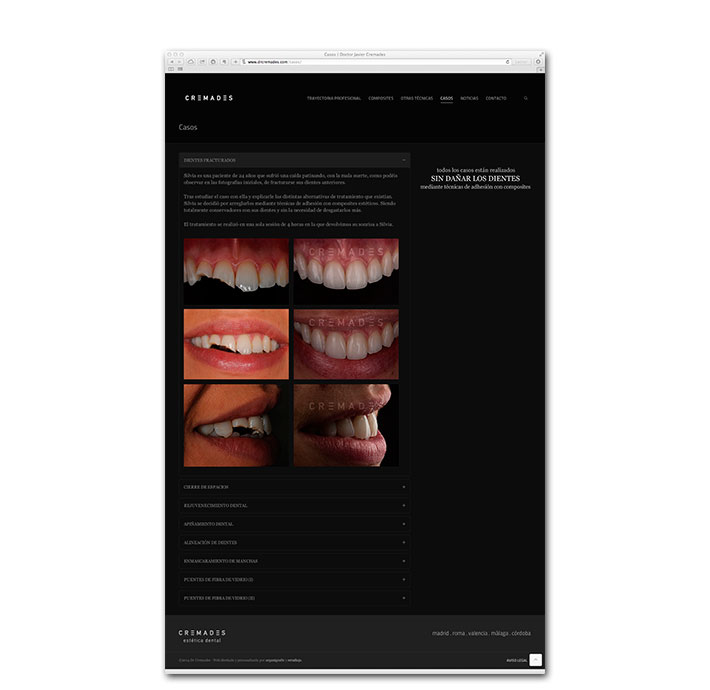 Diseño Web Cremades Estética Dental - Detalle de casos